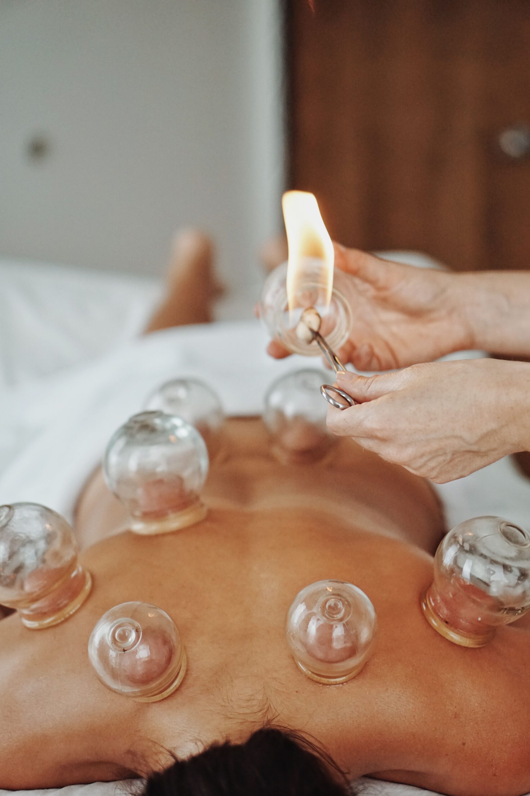 Uncovering the Benefits of Cupping Therapy