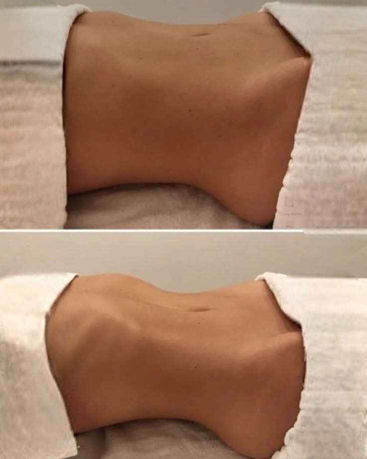 Self‑Massage Techniques to Release Tension